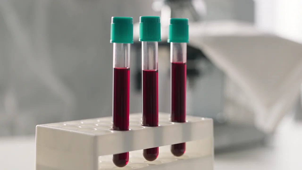 Blood test